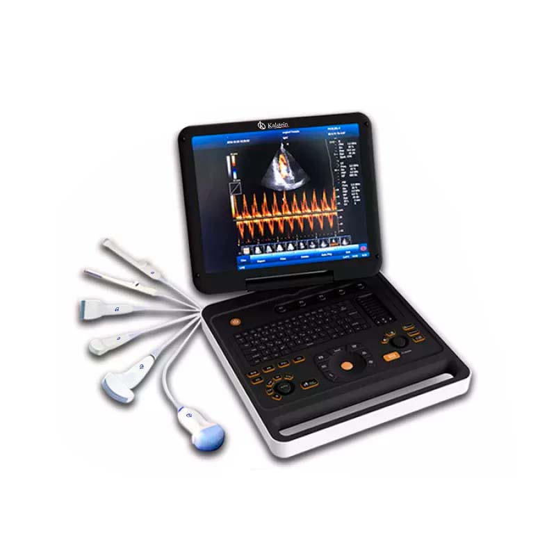 Factores clave a considerar